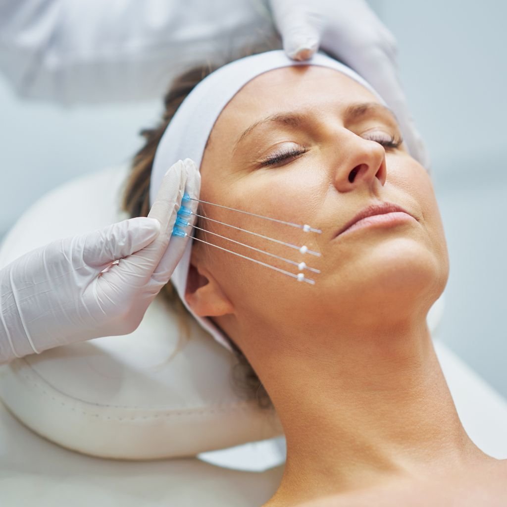 Ip ile Yuz Germe Medikal Estetik